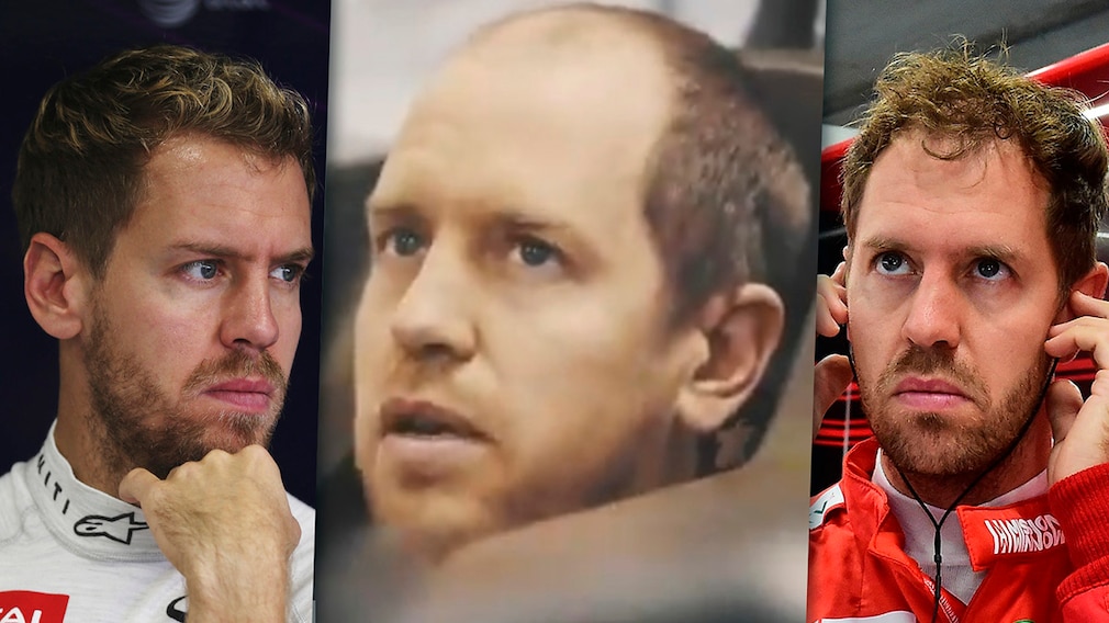 Formel 1: Vettel mit Stirnglatze